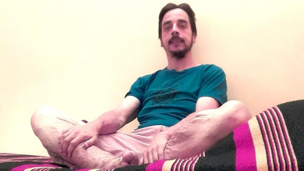 Bajó 158 kilos y asegura que la obesidad no se cura